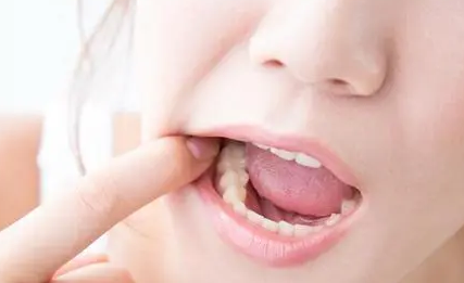 口腔烫的水泡能不能自己好，要多久能好呢