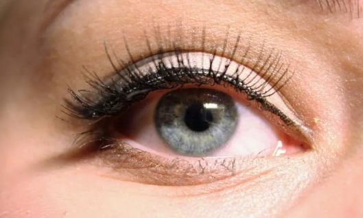 割双眼皮两个月了疤痕疙瘩会消除吗 割双眼皮疤痕疙瘩多久能消失