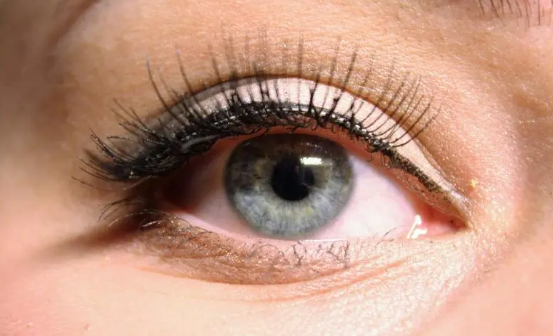 双眼皮紧绷感是割深的吗 双眼皮紧绷感是粘连引起的吗