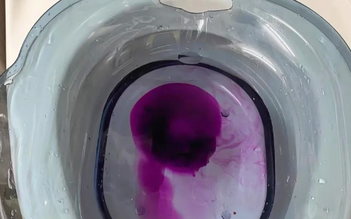 偶尔一次便血正常吗 拉屎出鲜血能自愈吗