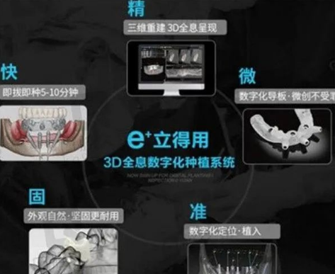 种植牙多少钱一颗2023价格表(2023年种植牙可以纳入医保吗) 种植牙多少钱一颗2023价格表(2023年种植牙可以纳入医保吗)