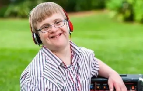 21三体综合征是指什么(21三体综合征正常范围是多少) 21三体综合征是指什么(21三体综合征正常范围是多少)