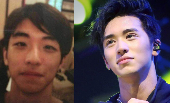 许魏洲整容前照片曝光 旧照惨不忍睹屌丝气息扑面而来 2