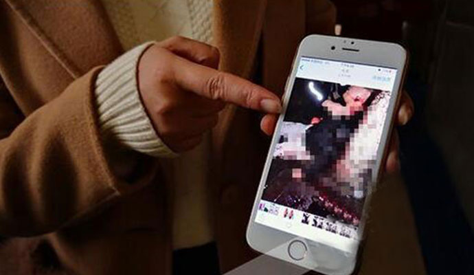 小伙突遭割破静脉 妻子目睹全程被吓懵现场曝光