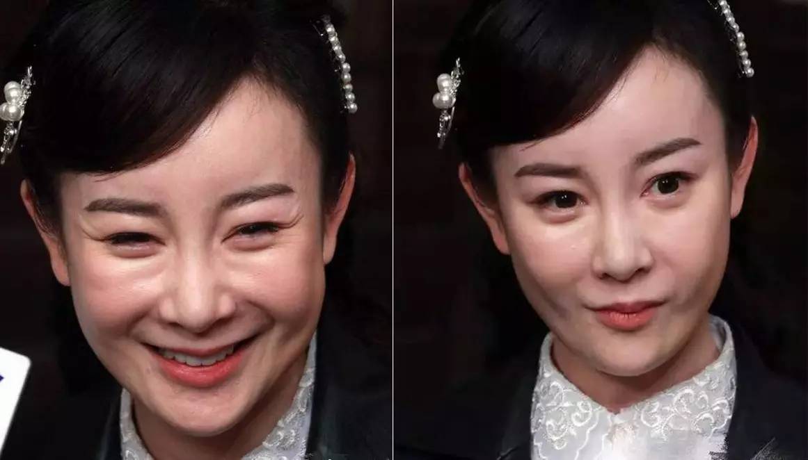 尚雯婕整容前后照片（娱乐圈10位被整容毁掉的女星）
