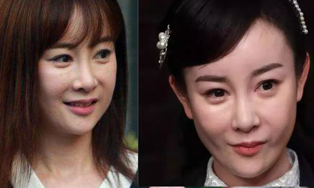 尚雯婕整容前后照片（娱乐圈10位被整容毁掉的女星）