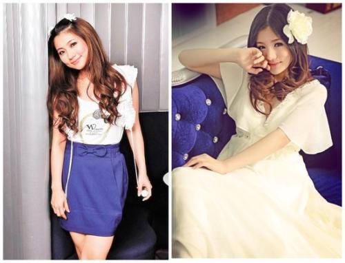 俞灏明是因为什么被烧伤的（selina俞灏明烧伤事件真相）