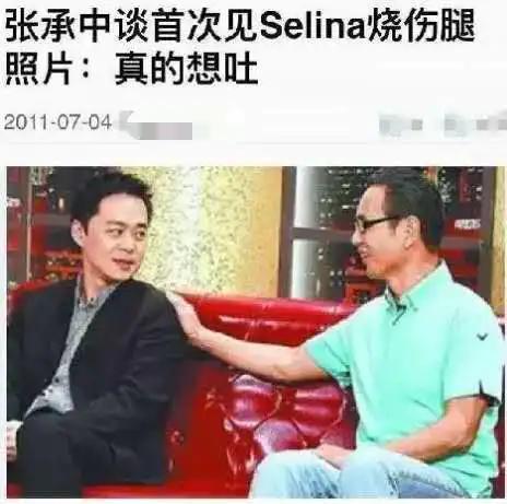 俞灏明是因为什么被烧伤的（selina俞灏明烧伤事件真相）