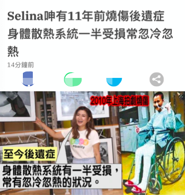 俞灏明是因为什么被烧伤的（selina俞灏明烧伤事件真相）