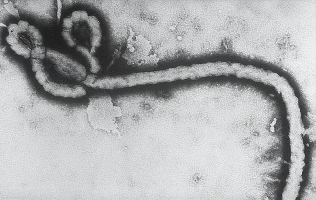 埃博拉病毒为什么突然消失（史上最强病毒埃博拉的来历）