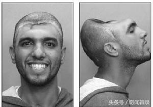 美国半脑哥活了多久（医学奇迹半脑哥智商正常吗）