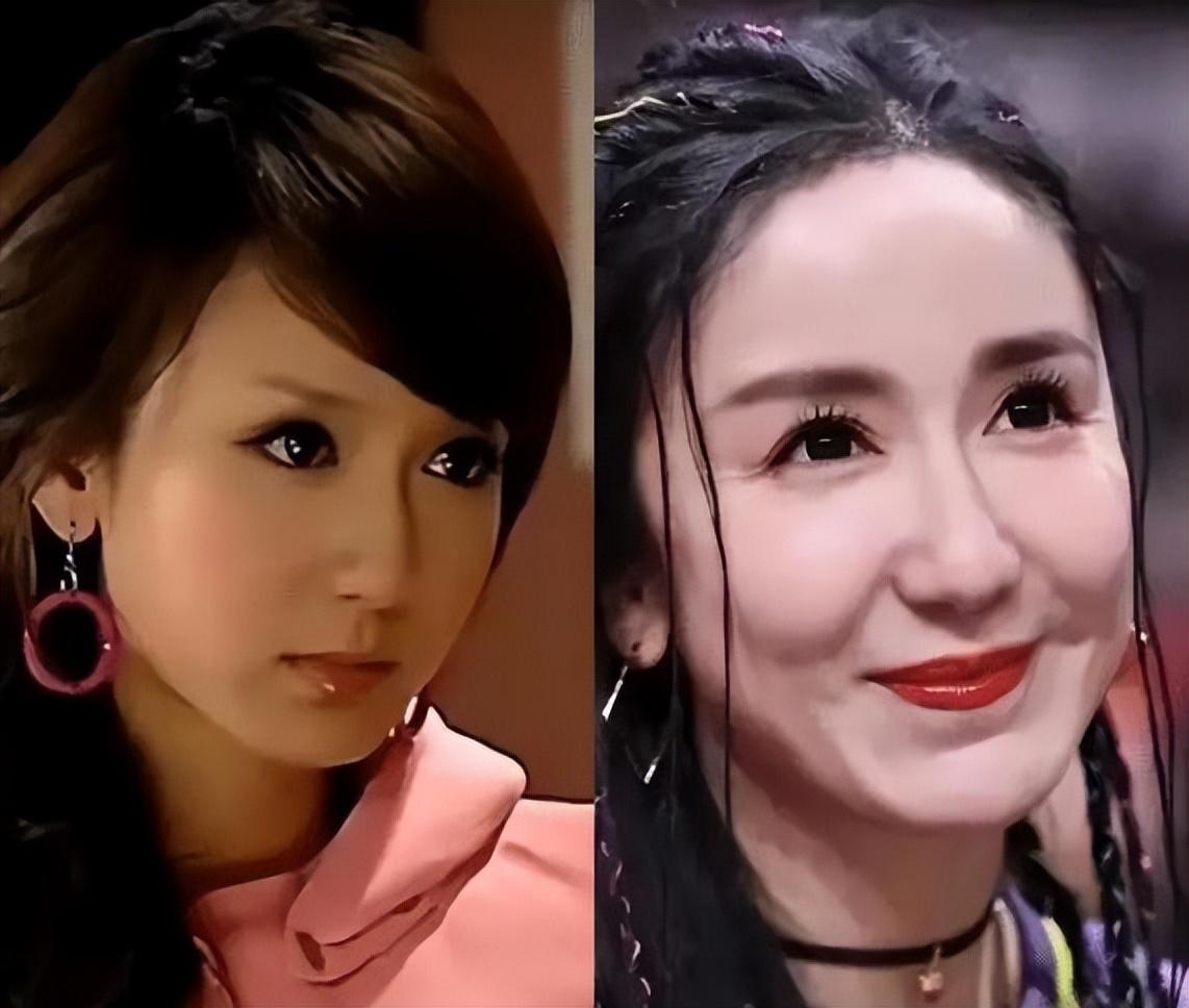 爱情公寓邓家佳整容了嘛（李金铭整容前后照片对比）