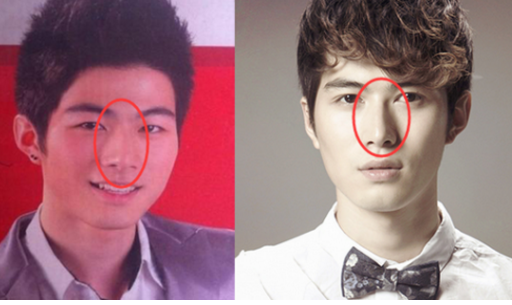 陈学冬的脸怎么了（演员陈学冬整容前后照片）