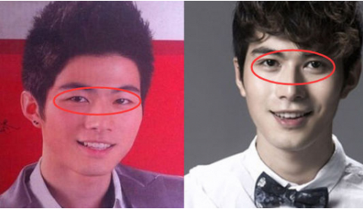 陈学冬的脸怎么了（演员陈学冬整容前后照片）