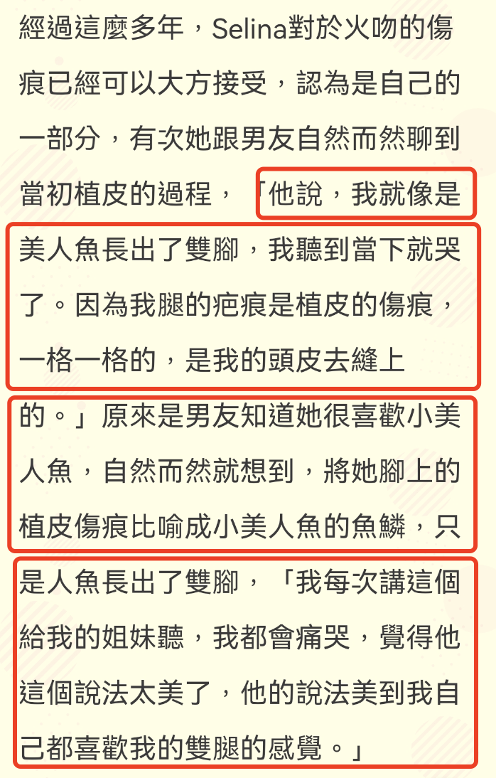 Selina拍戏被烧伤（任家萱烧伤前后对比照）