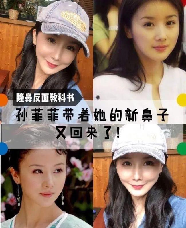 尚雯婕整容前后照片（娱乐圈10位被整容毁掉的女星）