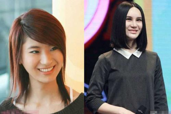 尚雯婕整容前后照片（娱乐圈10位被整容毁掉的女星）