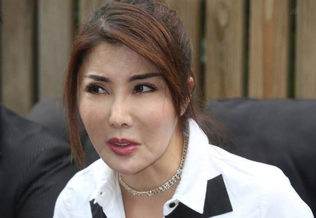 尚雯婕整容前后照片（娱乐圈10位被整容毁掉的女星）