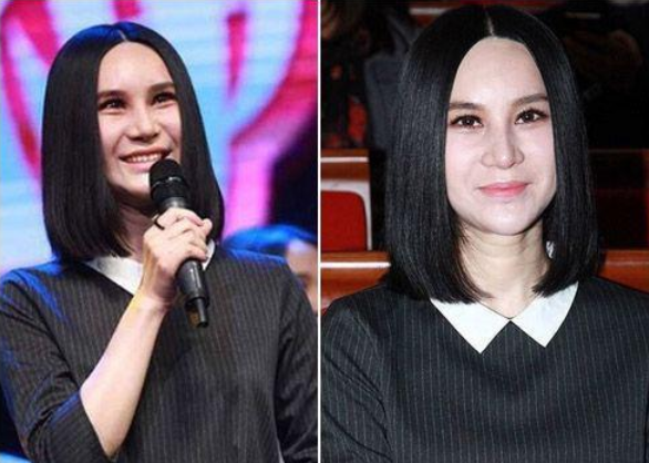 尚雯婕整容前后照片（娱乐圈10位被整容毁掉的女星）