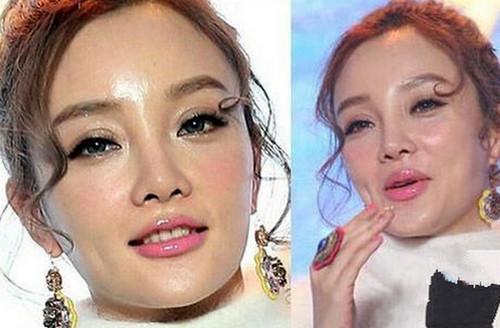 尚雯婕整容前后照片（娱乐圈10位被整容毁掉的女星）