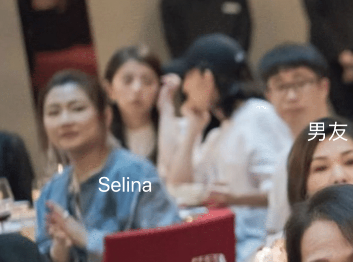 Selina拍戏被烧伤（任家萱烧伤前后对比照）