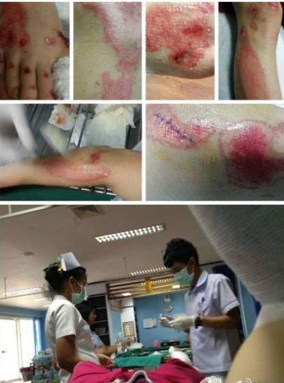 薛之谦被车撞了吗（李雨桐爆料薛之谦泰国车祸内幕）