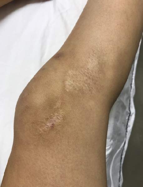 薛之谦被车撞了吗（李雨桐爆料薛之谦泰国车祸内幕）