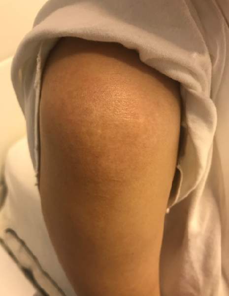 薛之谦被车撞了吗（李雨桐爆料薛之谦泰国车祸内幕）