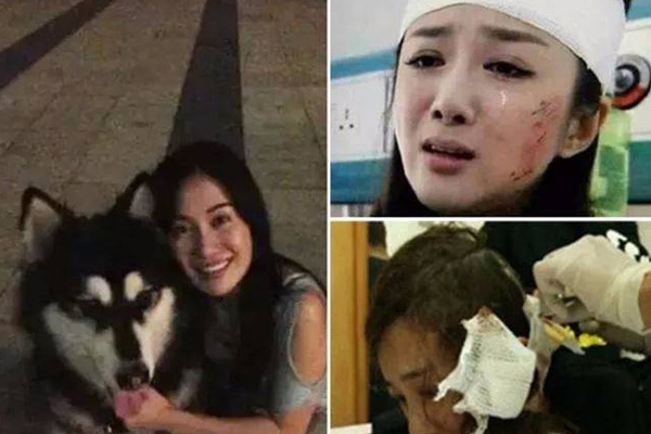 叶璇宠物狗撕咬李依晓事件