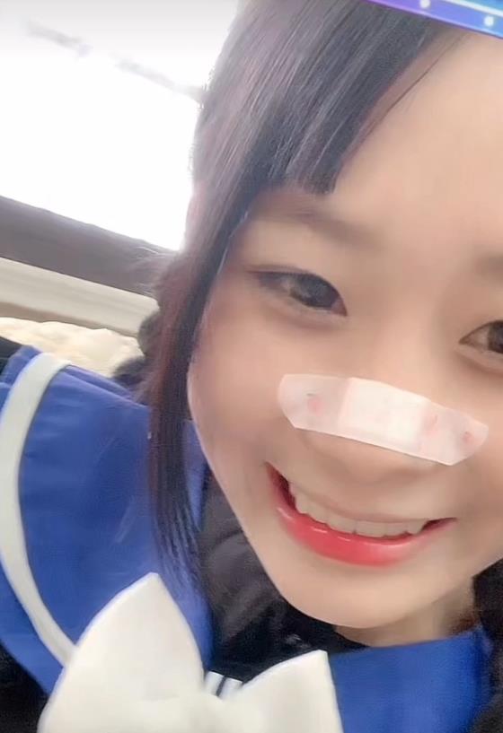 安静公主鼻子没有创口贴的样子