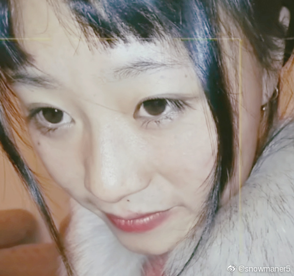 安静公主鼻子没有创口贴的样子