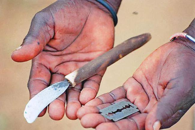 女性割礼是什么地方（非洲的索马里割礼习俗介绍）