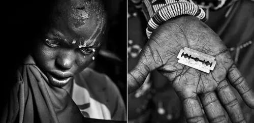 女性割礼是什么地方（非洲的索马里割礼习俗介绍）