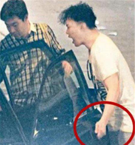 陈奕迅得了什么病（歌手陈奕迅睾丸受伤事件）