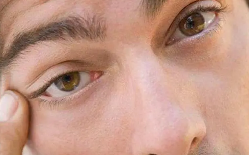 右眼皮跳是什么预兆女(为什么右眼皮会跳) 右眼皮跳是什么预兆女(为什么右眼皮会跳)