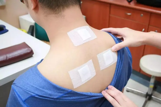 三伏贴每次都贴相同位置吗(三伏贴每次都贴同一个位置吗) 三伏贴每次都贴相同位置吗(三伏贴每次都贴同一个位置吗)