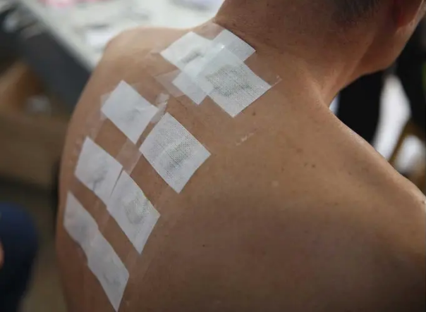 三伏贴贴半小时就撕了有用吗（三伏贴贴30分钟有效吗）