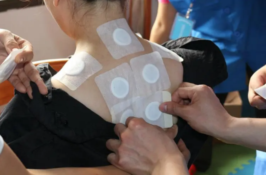 三伏贴能不能在非医疗机构贴吗（非医疗机构可以贴三伏贴吗）