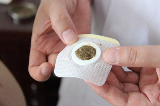 三伏贴可以隔7天贴下一贴吗（三伏贴间隔一星期可以贴第二贴吗）