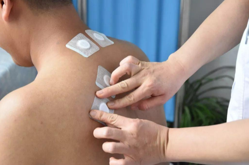 三伏贴价格不等效果一样吗（三伏贴价钱不等什么样的好）