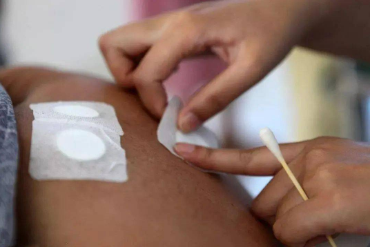 贴三伏贴了像针扎一样疼正常吗（三伏贴后针刺一样疼正常吗）