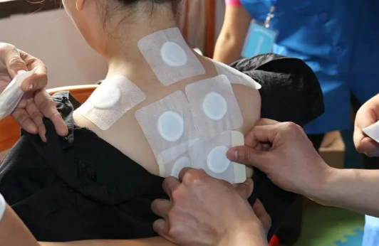 三伏贴中途漏了一贴有没有效果(三伏贴中间少了一次效果如何) 三伏贴中途漏了一贴有没有效果(三伏贴中间少了一次效果如何)