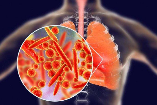 支原体肺炎会传染给大人吗（支原体肺炎会传染给小孩吗）