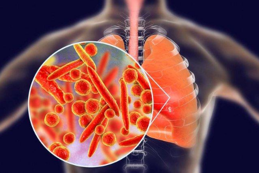 支原体肺炎感染一次还会再感染吗（支原体肺炎好了之后还会二次感染吗）